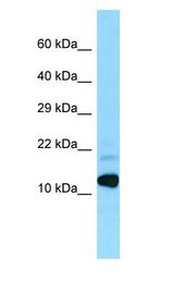 BRI3 antibody Western Blot of Fetal Heart.