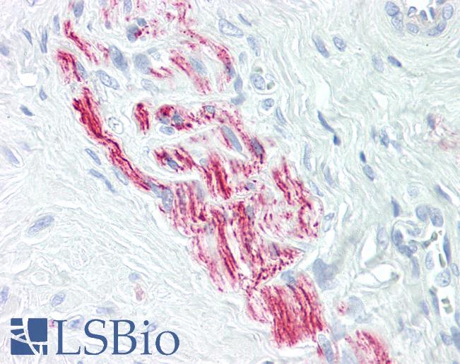 Anti-BRI3BP antibody IHC of human nerve. Immunohistochemistry of formalin-fixed, paraffin-embedded tissue after heat-induced antigen retrieval. Antibody LS-B8427 dilution 5 ug/ml.
