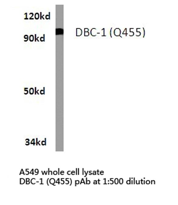 Western blot of Siah-1/2 (Q210) pAb in extracts from A549 cells.