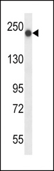 BRIP1 Antibody western blot of mouse bladder tissue lysates (35 ug/lane). The BRIP1 antibody detected the BRIP1 protein (arrow).