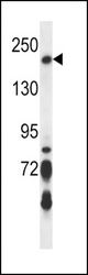 BRIP1 Antibody western blot of Jurkat cell line lysates (35 ug/lane). The BRIP1 antibody detected the BRIP1 protein (arrow).