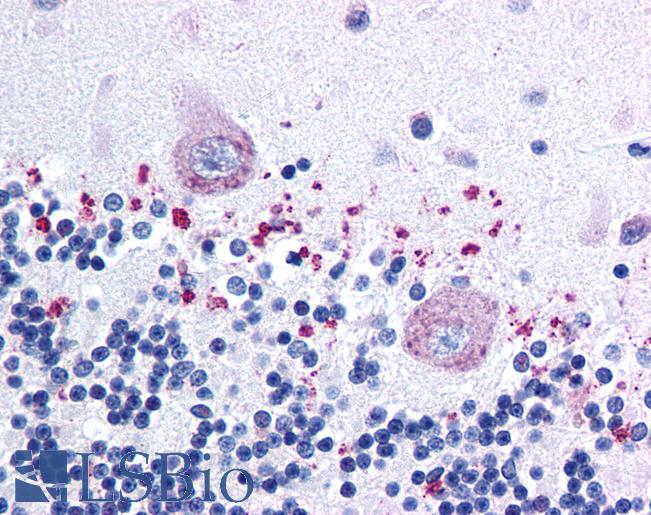 Anti-BRIP1 / FANCJ antibody IHC of human brain, cerebellum. Immunohistochemistry of formalin-fixed, paraffin-embedded tissue after heat-induced antigen retrieval. Antibody LS-B165 dilution 1:50.