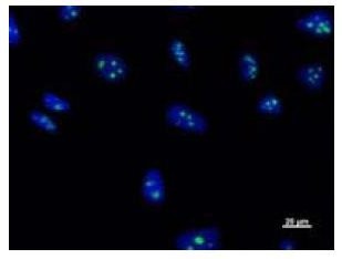 Immunofluorescent staining using BXDC2 antibody. Immunostaining analysis in HeLa cells. HeLa cells were fixed with 4% paraformaldehyde and permeabilized with 0.01% Triton-X100 in PBS. The cells were immunostained with anti-BXDC2 antibody. Nuclear was stained with Hoescht (blue fluorescence).