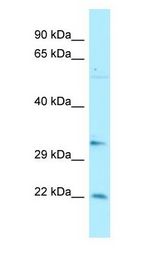 BRMS1 antibody Western Blot of 721_B cell lysate. BRMS1 is supported by BioGPS gene expression data to be expressed in 721_B.