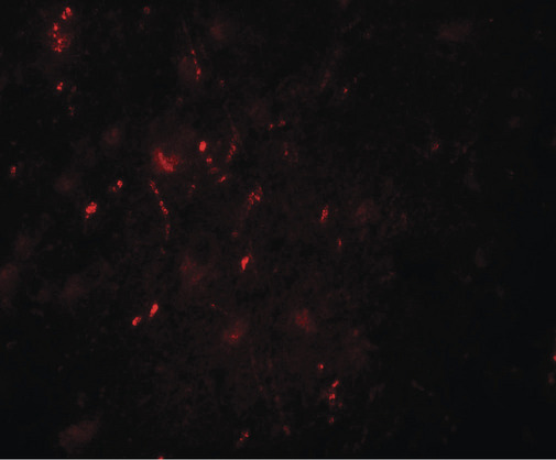 Immunofluorescence of POU3F2 in human brain tissue with POU3F2 antibody at 20 ug/ml.