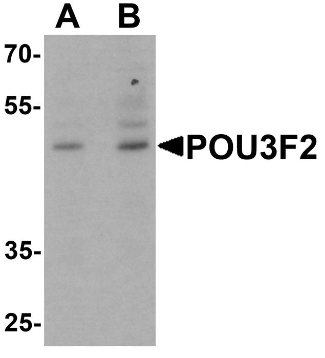 Western blot analysis of POU3F2 in 3T3 cell lysate with POU3F2 antibody at (A) 1 and (B) 2 ug/ml.