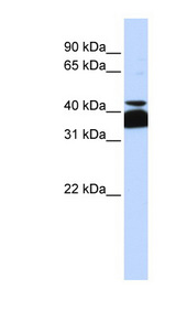 POU4F2 antibody LS-C110280 Western blot of Jurkat lysate.