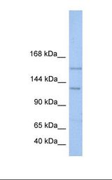 Jurkat cell lysate. Antibody concentration: 1.0 ug/ml. Gel concentration: 6-18%.