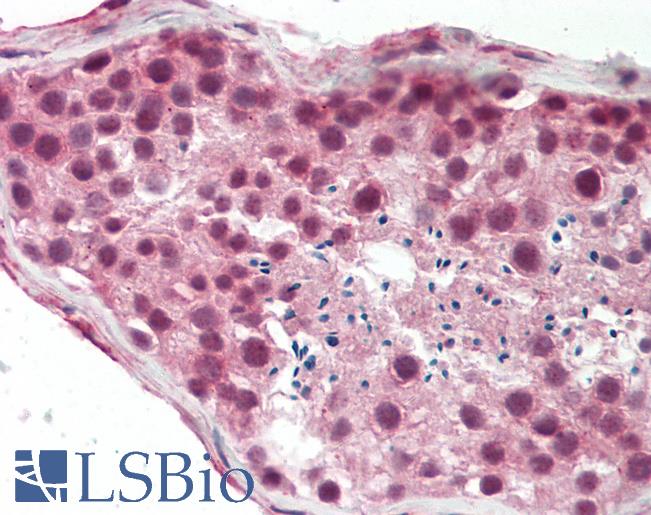 Human Testis: Formalin-Fixed, Paraffin-Embedded (FFPE)