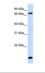 Hela cell lysate. Antibody concentration: 1.0 ug/ml. Gel concentration: 12%.