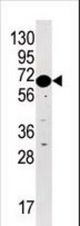 Western blot of anti-STK29 Pabin HL60 cell line lysate (35 ug/lane). STK29(arrow) was detected using the purified antibody.