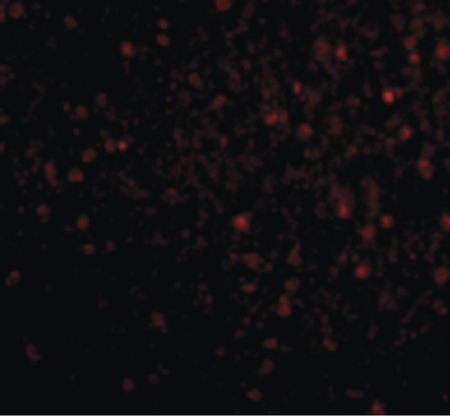Immunofluorescence of BRSK2 in Human Brain cells with BRSK2 antibody at 20 ug/ml.