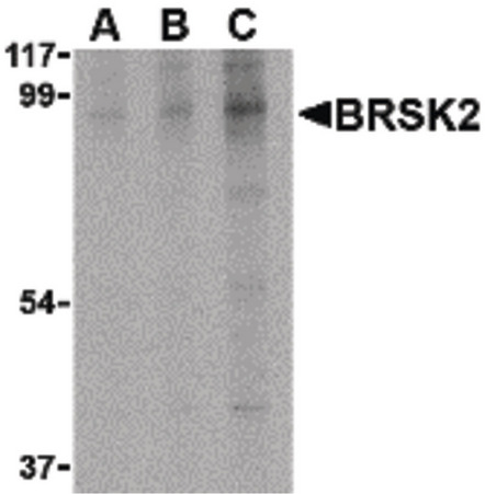 Western blot of BRSK2 in human brain tissue lysate with BRSK2 antibody at (A) 0.5, (B) 1 and (C) 2 ug/ml.