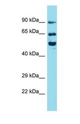 Western blot of BRSK2 Antibody with human HT1080 Whole Cell lysate.