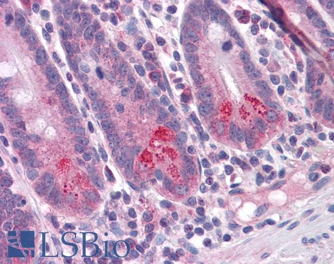 Anti-BIRC6 antibody IHC of human small intestine. Immunohistochemistry of formalin-fixed, paraffin-embedded tissue after heat-induced antigen retrieval. Antibody LS-B4702 concentration 5 ug/ml.