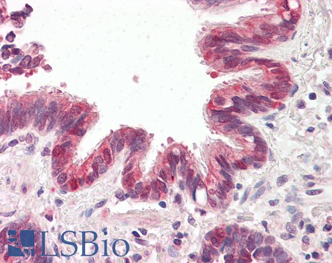 Anti-BRUCE / BIRC6 antibody IHC of human lung, respiratory epithelium. Immunohistochemistry of formalin-fixed, paraffin-embedded tissue after heat-induced antigen retrieval. Antibody LS-B8292 dilution 3.75 ug/ml.