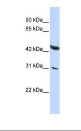 HepG2 cell lysate. Antibody concentration: 1.0 ug/ml. Gel concentration: 12%.