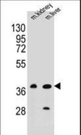 BRUNOL6 Antibody western blot of mouse kidney,liver tissue lysates (35 ug/lane). The BRUNOL6 antibody detected the BRUNOL6 protein (arrow).