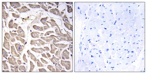 IHC of paraffin-embedded human heart tissue, using BRWD3 Antibody. The sample on the right was incubated with synthetic peptide.