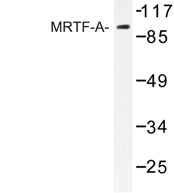 Western blot of MRTF-A (H11) pAb in extracts from HUVEC cells.