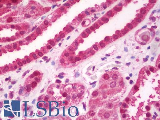 Anti-BSAC / MKL1 antibody IHC staining of human kidney. Immunohistochemistry of formalin-fixed, paraffin-embedded tissue after heat-induced antigen retrieval. Antibody LS-B11058 dilution 1:100.