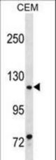 MKL1 Antibody western blot of CEM cell line lysates (35 ug/lane). The MKL1 antibody detected the MKL1 protein (arrow).