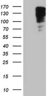 HEK293T cells were transfected with the pCMV6-ENTRY control (Left lane) or pCMV6-ENTRY MKL1 (Right lane) cDNA for 48 hrs and lysed. Equivalent amounts of cell lysates (5 ug per lane) were separated by SDS-PAGE and immunoblotted with anti-MKL1.