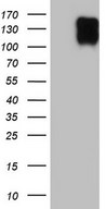 HEK293T cells were transfected with the pCMV6-ENTRY control (Left lane) or pCMV6-ENTRY MKL1 (Right lane) cDNA for 48 hrs and lysed. Equivalent amounts of cell lysates (5 ug per lane) were separated by SDS-PAGE and immunoblotted with anti-MKL1.