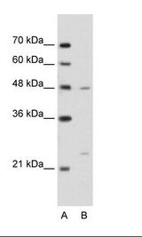 A: Marker, B: Jurkat Cell Lysate