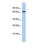 Western blot of Human Fetal Liver. ACSL6 antibody dilution 1.0 ug/ml.