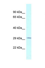 BSPRY antibody LS-C145788 Western blot of Fetal Heart lysate. Antibody concentration 1 ug/ml.