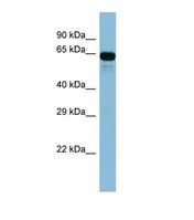 Western blot of Human Fetal Kidney. ACSL6 antibody dilution 1.0 ug/ml.
