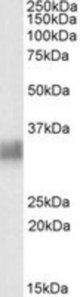 BST2 antibody (0.3 ug/ml) staining of Human Spleen lysate (35 ug protein/ml in RIPA buffer). Primary incubation was 1 hour. Detected by chemiluminescence.