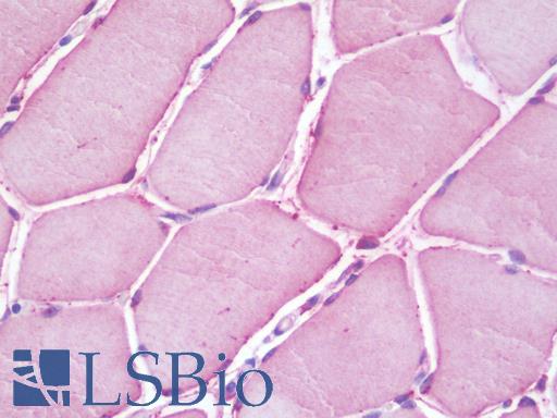 Anti-ACSL6 antibody IHC staining of human skeletal muscle. Immunohistochemistry of formalin-fixed, paraffin-embedded tissue after heat-induced antigen retrieval. Antibody LS-B9840 concentration 10 ug/ml.