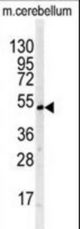 Western blot of BTBD1 antibody in mouse cerebellum tissue lysates (35 ug/lane). BTBD1 (arrow) was detected using the purified antibody.