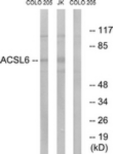 Western blot of extracts from COLO/Jurkat cells, using ACSL6 Antibody. The lane on the right is treated with the synthesized peptide.