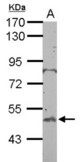 Sample (50 ug of whole cell lysate) A: mouse testis 10% SDS PAGE BTBD10 antibody diluted at 1:500
