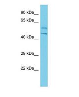 Western blot of BTBD16 Antibody - N-terminal region with human HepG2 cells lysate.