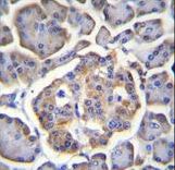 BTBD17 Antibody immunohistochemistry of formalin-fixed and paraffin-embedded human pancreas tissue followed by peroxidase-conjugated secondary antibody and DAB staining.