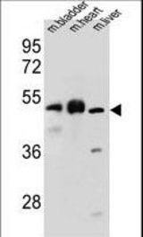 BTBD17 Antibody western blot of mouse bladder,heart,liver tissue lysates (35 ug/lane). The BTBD17 antibody detected the BTBD17 protein (arrow).