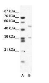 A: Marker, B: Jurkat Cell Lysate
