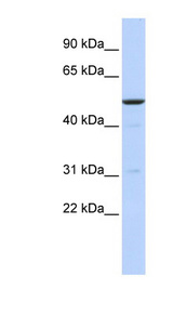 BTBD3 antibody LS-C101492 Western blot of MCF7 cell lysate.