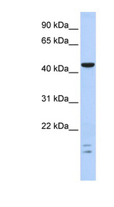 BTBD6 antibody LS-C101794 Western blot of Fetal Brain lysate.