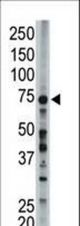 The anti-FACL6 antibody is used in Western blot to detect FACL6 in mouse liver tissue lysate.