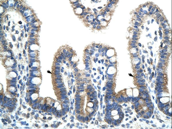 BTBD6 antibody LS-C30978 was used in IHC to stain formalin-fixed, paraffin-embedded human intestine.