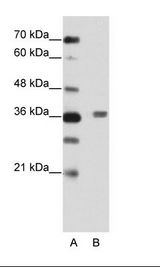 A: Marker, B: HepG2 Cell Lysate