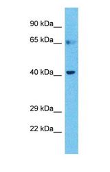 Western blot of BTBD6 Antibody with human Stomach Tumor lysate.