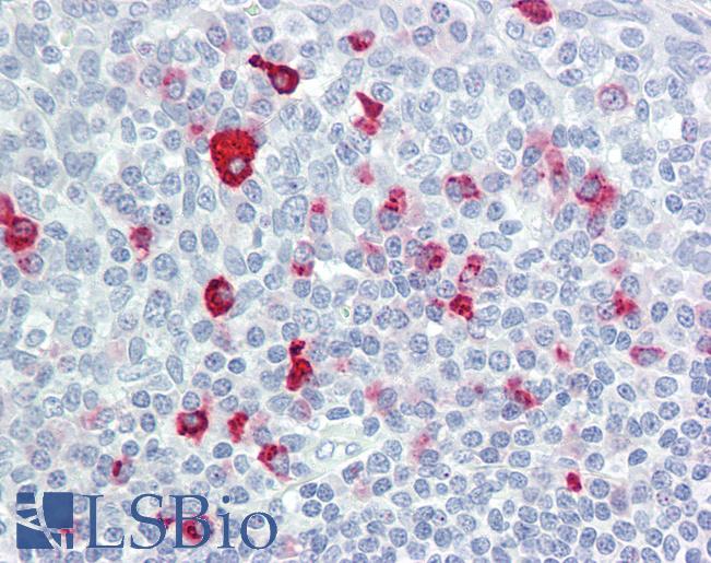Anti-BTBD6 antibody IHC of human tonsil. Immunohistochemistry of formalin-fixed, paraffin-embedded tissue after heat-induced antigen retrieval. Antibody LS-B8429 dilution 5 ug/ml.