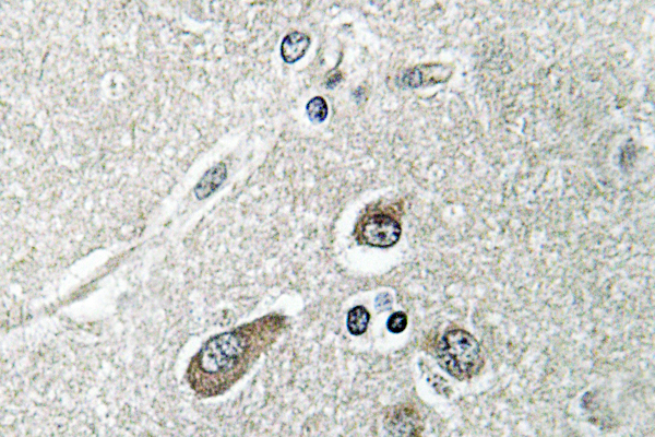 IHC of ACSL6 (D531) pAb in paraffin-embedded human brain tissue.