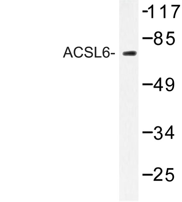 Western blot of ACSL6 (D531) pAb in extracts from COLO/Jurkat cells.